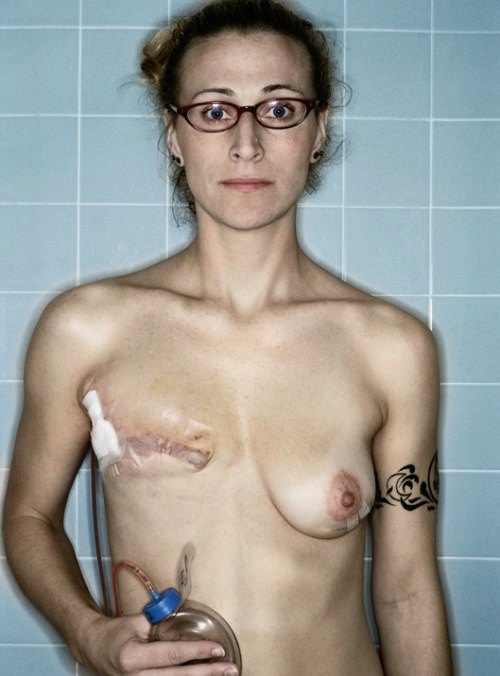 Kerry Mansfield foi diagnosticada com câncer de mama em 2005, e acabou fotografando todo o seu tratamento numa série de auto-retratos que mostram a evolução do seu corpo durante esse tempo.