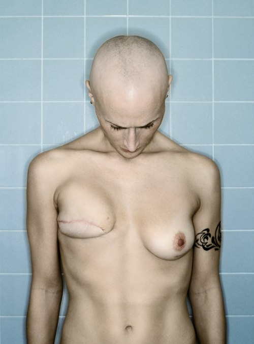 Kerry Mansfield foi diagnosticada com câncer de mama em 2005, e acabou fotografando todo o seu tratamento numa série de auto-retratos que mostram a evolução do seu corpo durante esse tempo.