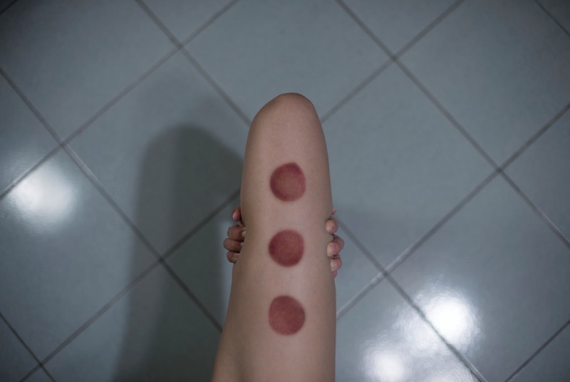Yung Cheng Lin é uma artista de Taiwan que visualiza os problemas das mulheres de hoje, os problemas da sociedade e a modificação corporal através da fotografia. A artista interpreta seus temas usando ferramentas básicas e o corpo humano como lugar para enviar uma mensagem.