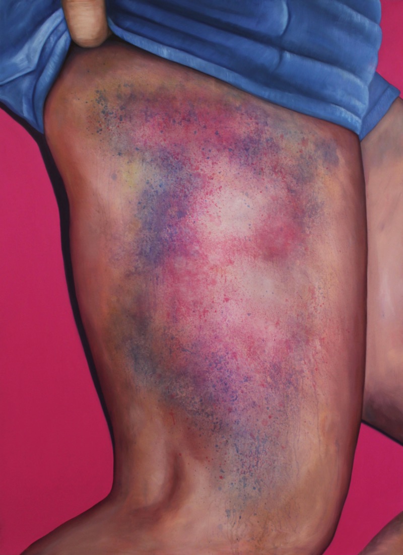 Riikka Hyvönen começou esse estranho projeto de arte quando passou a colecionar fotografias dos roxos que as garotas que praticam roller derby acabam tendo. Foi assim que surgiu a ideia do Roller Derby Kisses.