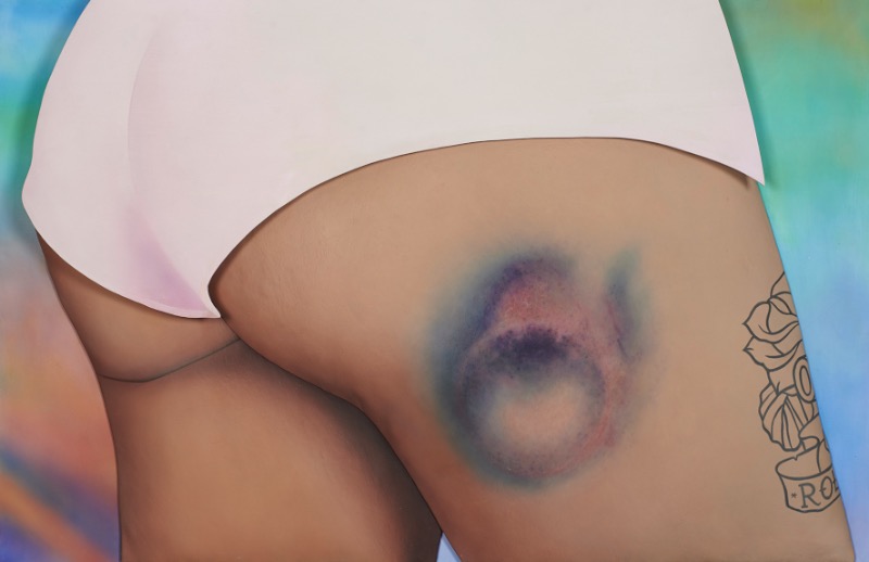 Riikka Hyvönen começou esse estranho projeto de arte quando passou a colecionar fotografias dos roxos que as garotas que praticam roller derby acabam tendo. Foi assim que surgiu a ideia do Roller Derby Kisses.