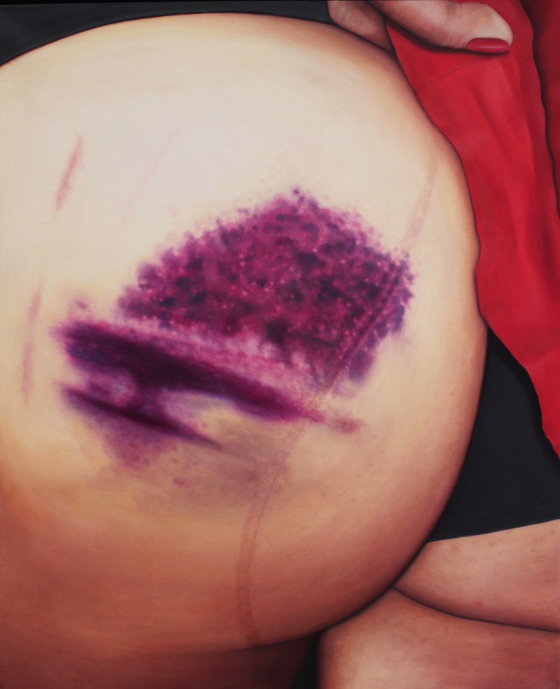 Riikka Hyvönen começou esse estranho projeto de arte quando passou a colecionar fotografias dos roxos que as garotas que praticam roller derby acabam tendo. Foi assim que surgiu a ideia do Roller Derby Kisses.