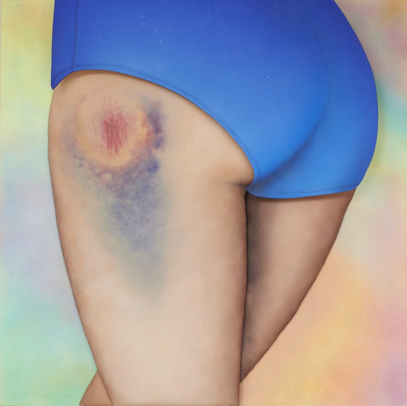Riikka Hyvönen começou esse estranho projeto de arte quando passou a colecionar fotografias dos roxos que as garotas que praticam roller derby acabam tendo. Foi assim que surgiu a ideia do Roller Derby Kisses.