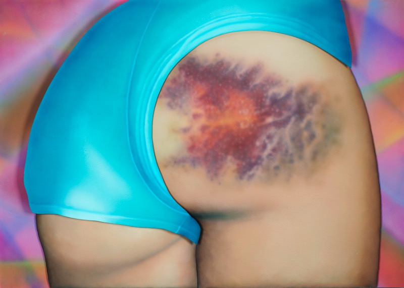 Riikka Hyvönen começou esse estranho projeto de arte quando passou a colecionar fotografias dos roxos que as garotas que praticam roller derby acabam tendo. Foi assim que surgiu a ideia do Roller Derby Kisses.