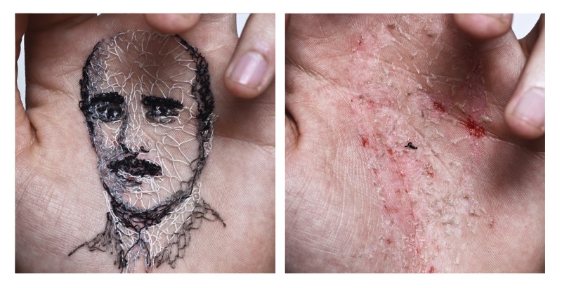 Usando da sua própria carne como tela e agulhas como ferramentas de trabalho, o artista David Cata abusa da sua própria pele para se expressar de forma criativa. É assim que ele cria as imagens que você pode ver aqui e que, muitas pessoa, podem considerar um pouco demais. Mas, arte é isso mesmo. Algumas pessoas não entendem mas, mesmo assim, precisa existir de uma forma ou de outra.