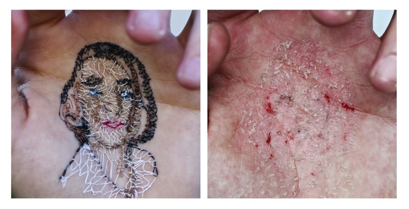 Usando da sua própria carne como tela e agulhas como ferramentas de trabalho, o artista David Cata abusa da sua própria pele para se expressar de forma criativa. É assim que ele cria as imagens que você pode ver aqui e que, muitas pessoa, podem considerar um pouco demais. Mas, arte é isso mesmo. Algumas pessoas não entendem mas, mesmo assim, precisa existir de uma forma ou de outra.