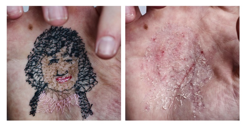 Usando da sua própria carne como tela e agulhas como ferramentas de trabalho, o artista David Cata abusa da sua própria pele para se expressar de forma criativa. É assim que ele cria as imagens que você pode ver aqui e que, muitas pessoa, podem considerar um pouco demais. Mas, arte é isso mesmo. Algumas pessoas não entendem mas, mesmo assim, precisa existir de uma forma ou de outra.