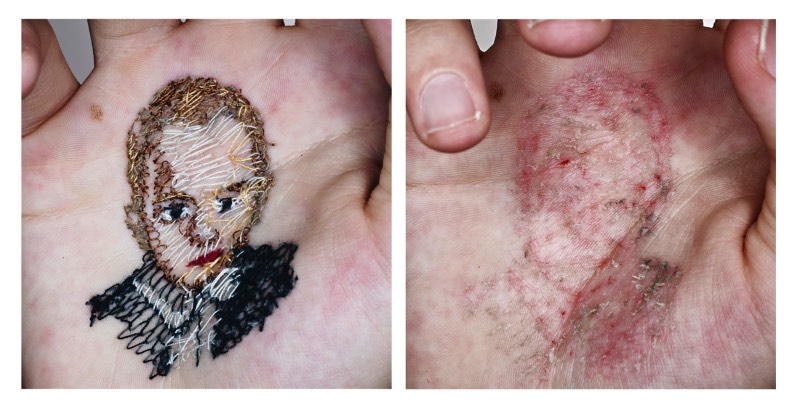 Usando da sua própria carne como tela e agulhas como ferramentas de trabalho, o artista David Cata abusa da sua própria pele para se expressar de forma criativa. É assim que ele cria as imagens que você pode ver aqui e que, muitas pessoa, podem considerar um pouco demais. Mas, arte é isso mesmo. Algumas pessoas não entendem mas, mesmo assim, precisa existir de uma forma ou de outra.
